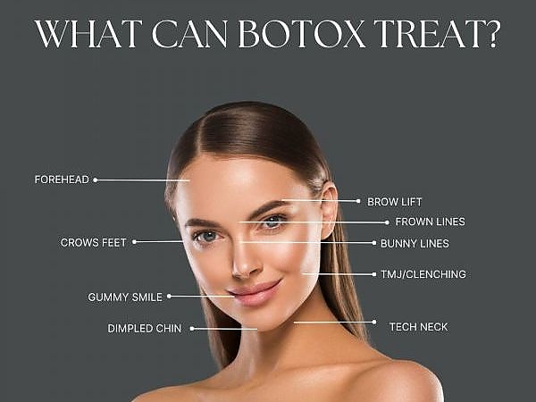  Botox Info